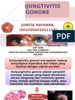 Juwita Rayhana (Konjungtivitis Gonore)