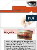 blefaritis-131026110258-phpapp01.pptx