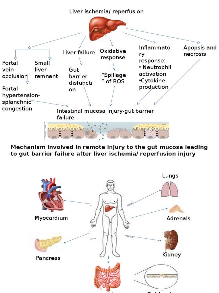Liver Ischemia/Reperfusion Injury Mechanisms | PDF | Science & Mathematics