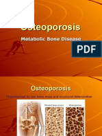 Osteo Ma Laci a Osteoporosis