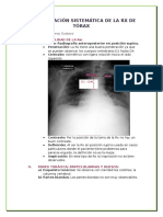 Interpretación Sistemática de La Rx de Tórax