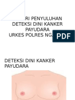 Deteksi Kanker Payudara 3