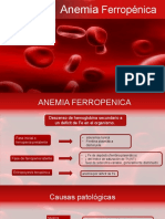 Anemia Ferropénica Expo Done