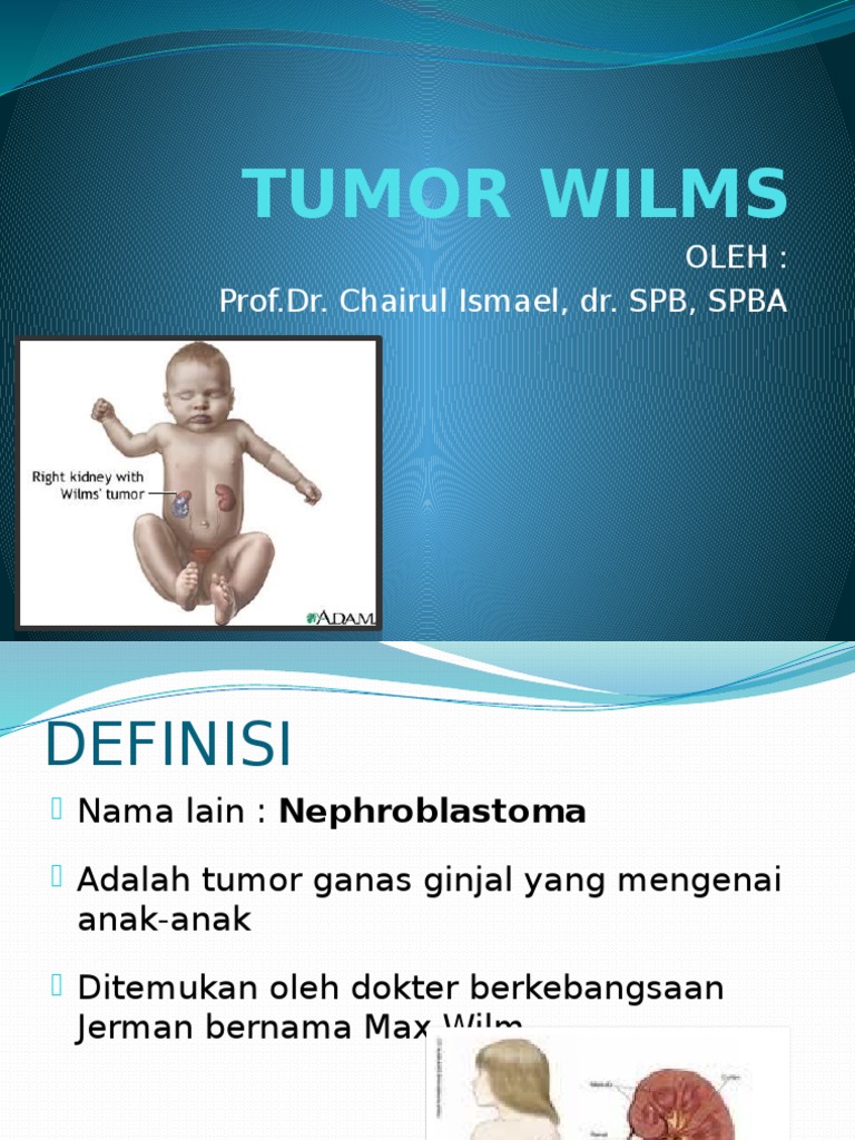 Tumor Wilms 02 | PDF