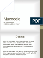 231246282-Mucocele-Fix