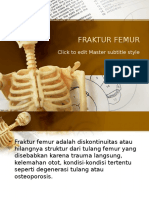 Fraktur Femur