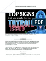 Top Signs That You Could Have an Underactive Thyroid
