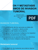 Exposicion Metastasis Invasion Tumoral