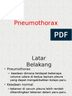 Cara Mengatasi Pneumothorax Secara Alami
