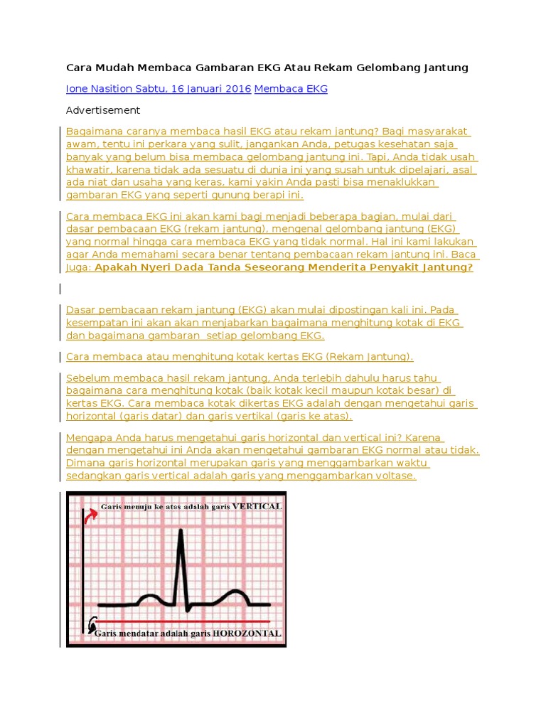Cara Mudah Membaca Gambaran EKG Atau Rekam Gelombang Jantung