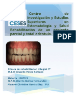 Rehabilitacion de Un Paciente Desdentado