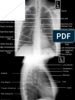 thorax foto.ppt