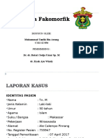 192407162 Referat Glaukoma Fakomorfik