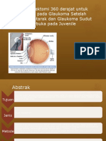 Trabekulektomi 360 Derajat Untuk Refraksi Pada Glaukoma 