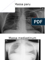 Tugas Radiologi Sanah IPD