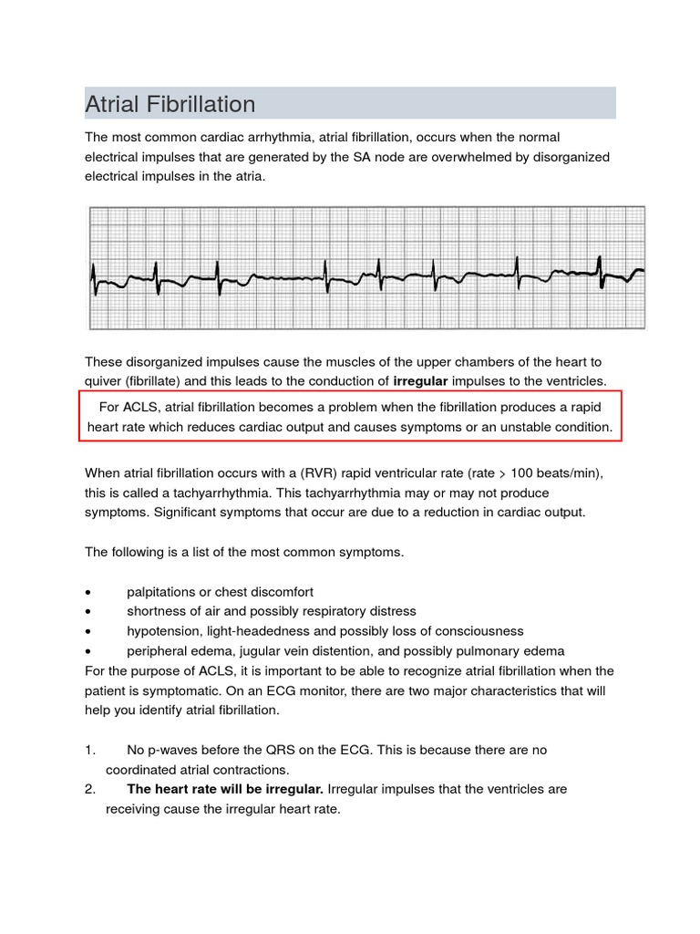 Atrial Fibrillation: The Heart Rate Will Be Irregular. Irregular ...