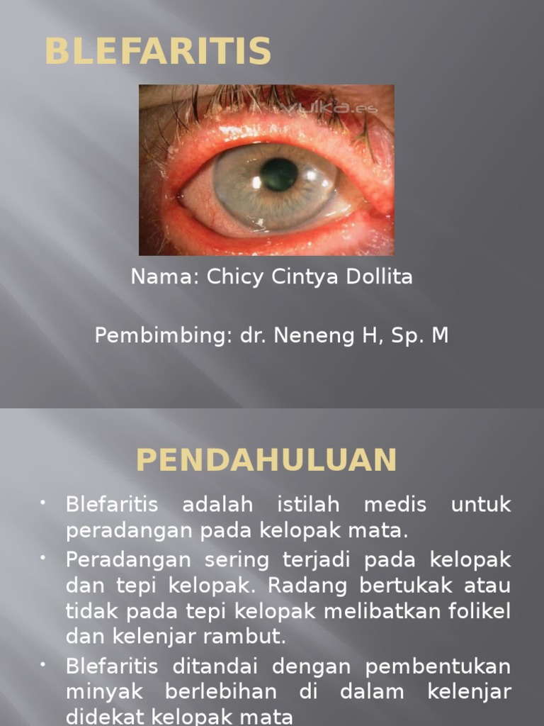 Pengantar Blefaritis dan Penanganannya | PDF