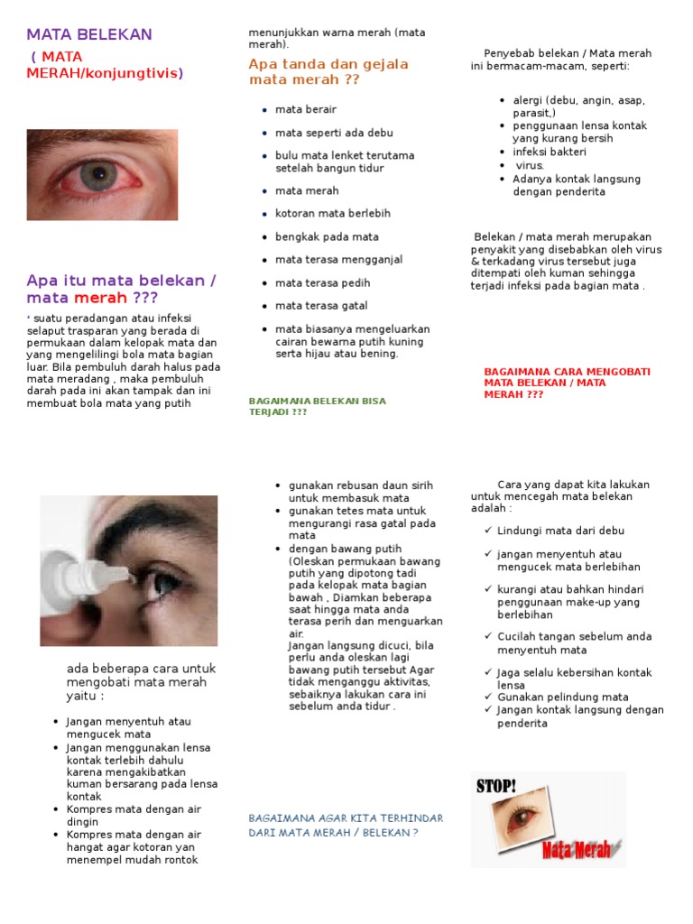 Mata Belekan Leaflet | PDF