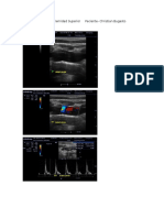 Protocolo Arterial Extremidad Superior Imagenes