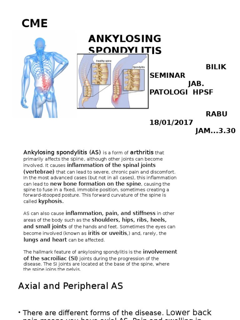 Ankylosing Spondylitis Overview and Management | PDF | Rheumatoid ...