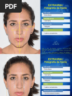 Análisis Facial y Dental Detallado | PDF | Ortodoncia | Odontología