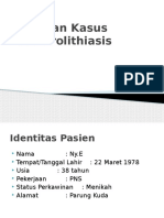 Ureterolithiasis
