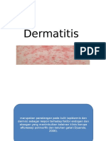 Fitoterapi Dermatitis Tinea Versicolor.pptx