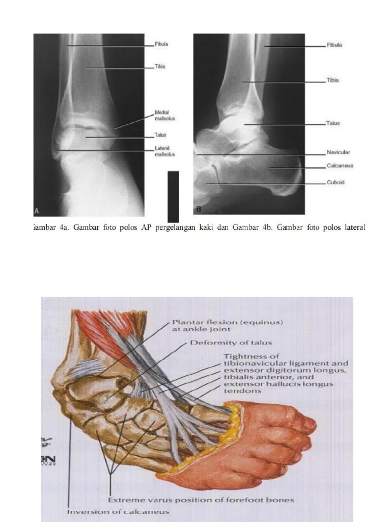 Gambar CTEV | PDF