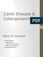 Caroli Disease and Cholangiocarcinoma