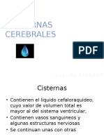 Cisternas Cerebrales