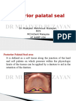 Posterior Palatal Seal: DR Muaiyed Buzayan