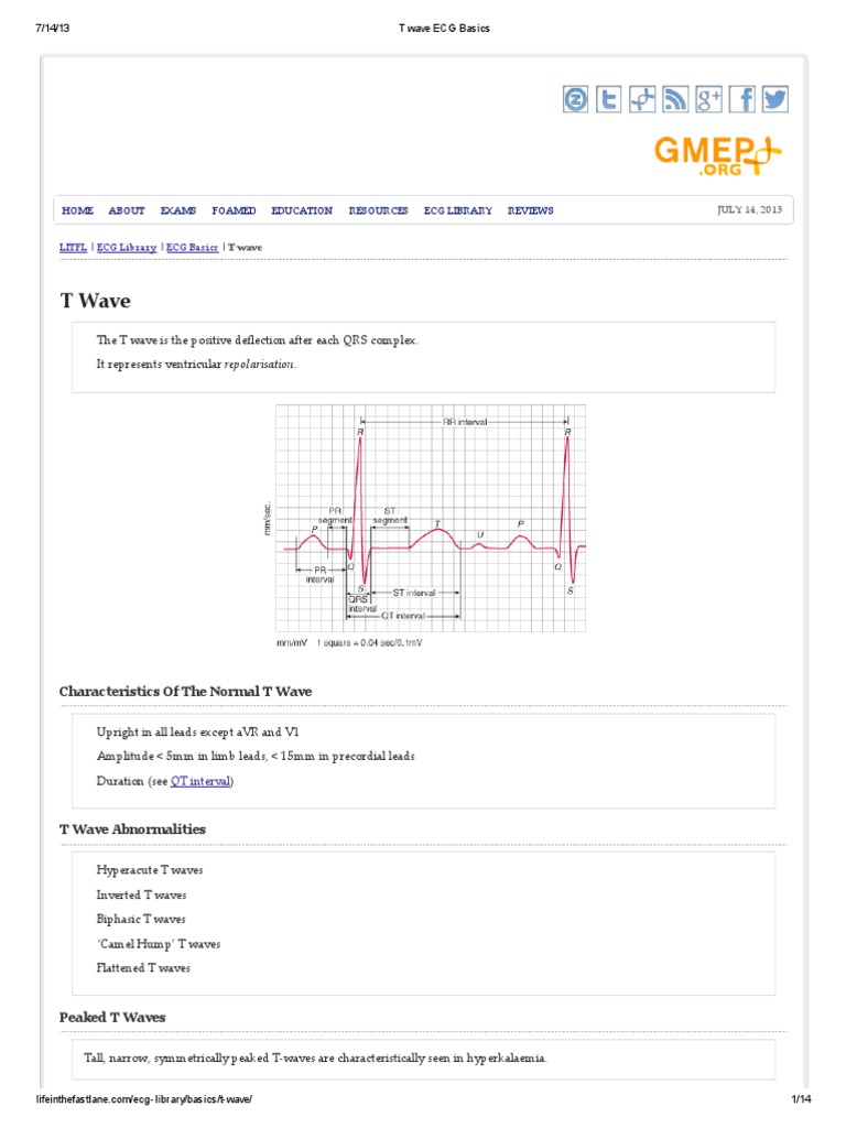 T Wave ECG Basics | PDF | Electrocardiography | Electrophysiology