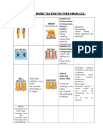 Puntos De Impactación En Fibromialgia.docx