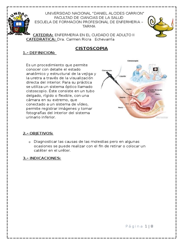 Cistoscopia: Definición y Procedimiento | PDF | Vejiga urinaria | Orina