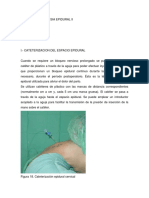 Bloqueo y Anestesia Epidural II