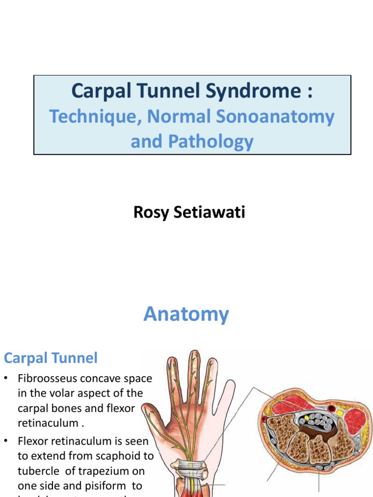 Carpal Tunnel Syndrome | PDF | Carpal Tunnel Syndrome | Hand