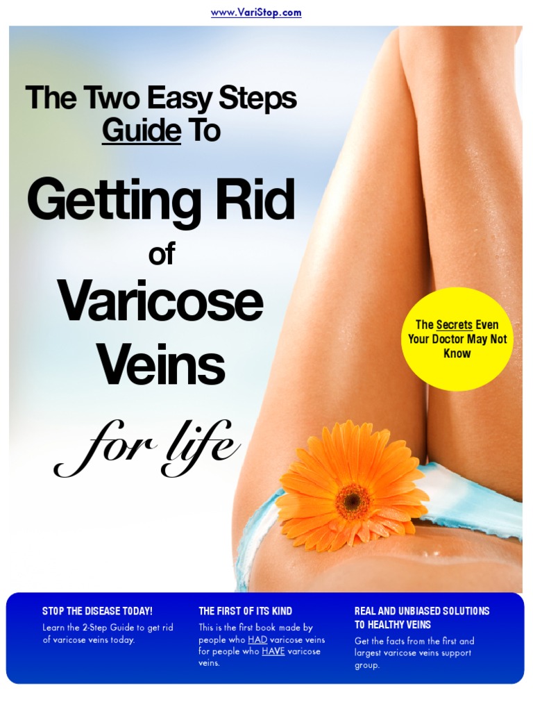 How To Get Rid Of Varices – Esophageal Varices: Symptoms, Causes ...