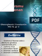 Sindromul Noonan