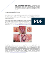 Alternatif Cara Mengobati Kutil Kelamin Secara Alami