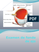 Examen de Fondo de Ojo (1)