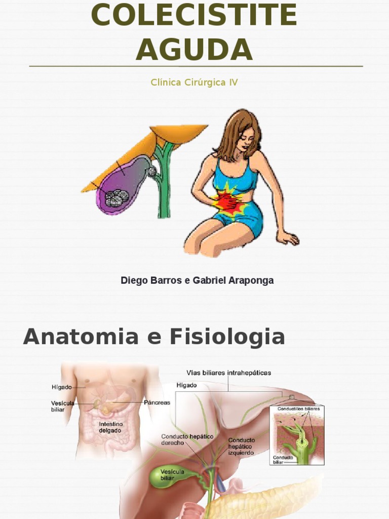 Colecistite Aguda