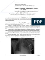 Delayed Diaphragmatic Hernia Diagnosis