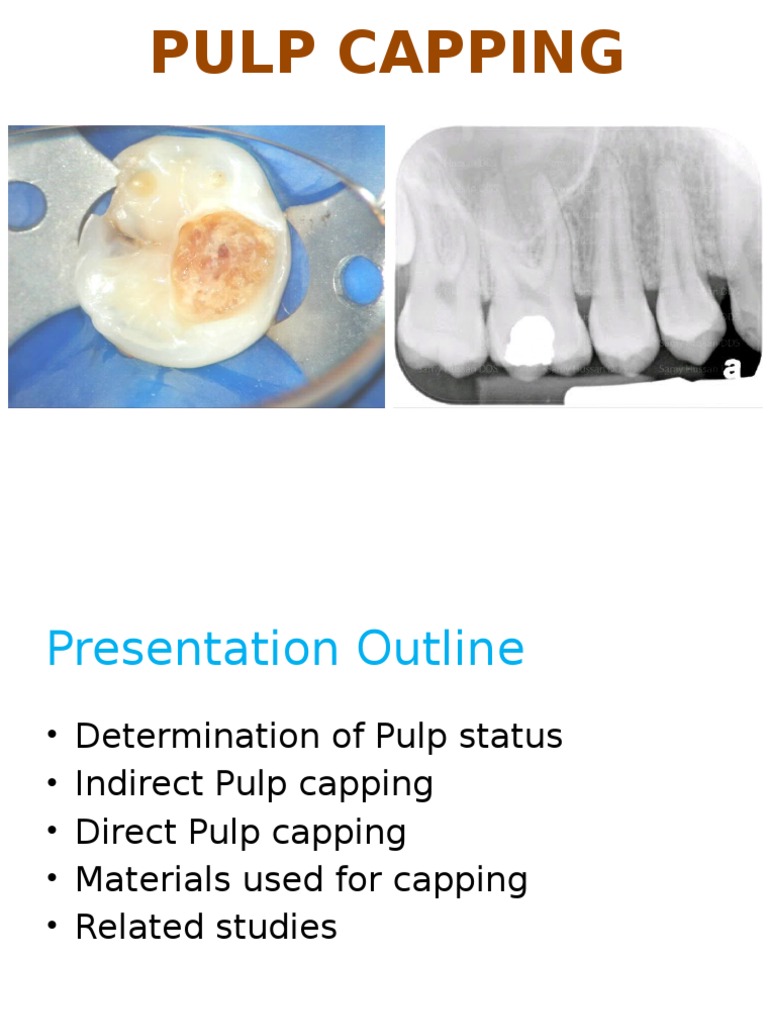 211858235-pulp-capping-pptx-dentin-human-tooth