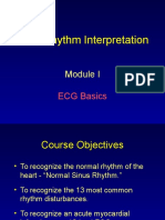 ECG Rhythm Interpretation Guide