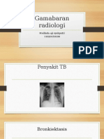 Gamabaran radiologi