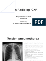 Tugas Radiologi CXR