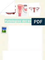 Patologías Del Ovario