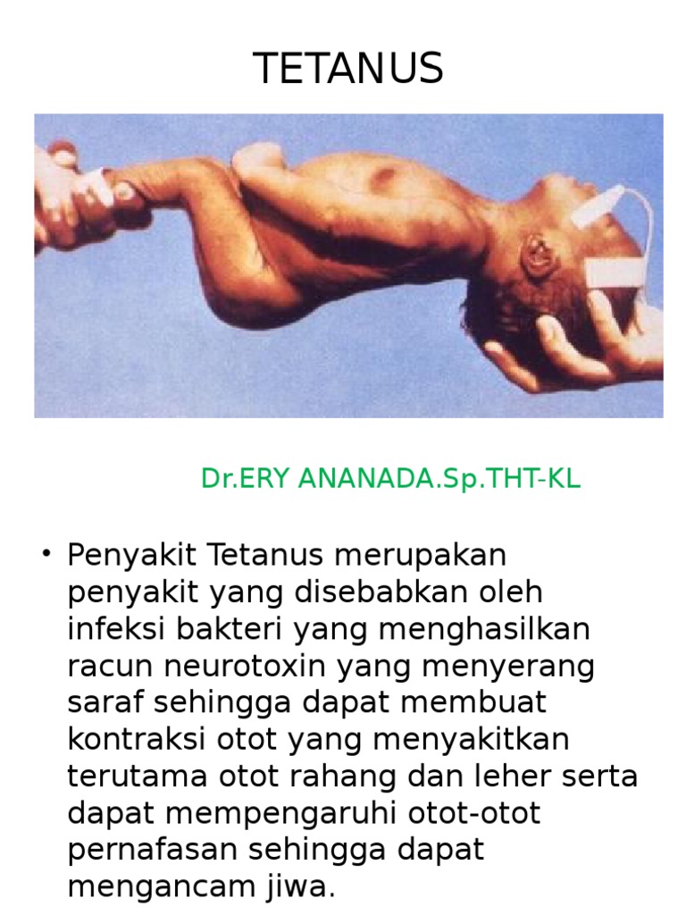 Tetanus | PDF