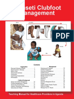 Treating Clubfoot