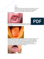 Anomali perkembangan lidah